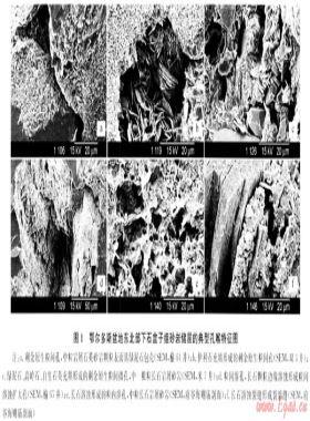 鄂爾多斯盆地東北部下石盒子組致密砂巖儲(chǔ)層特征及主控因素